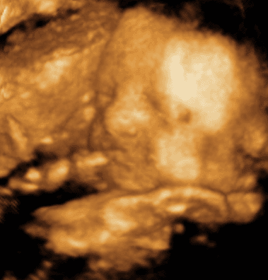 3 D Ultrasound. We had a 3D ultrasound last